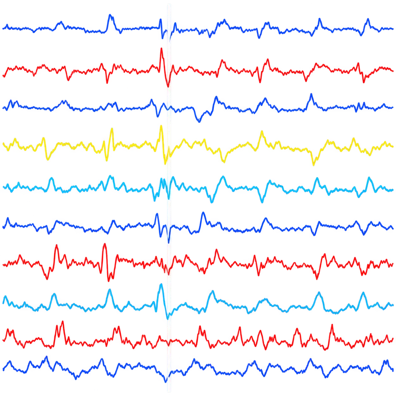 Multichannel EEG time series.